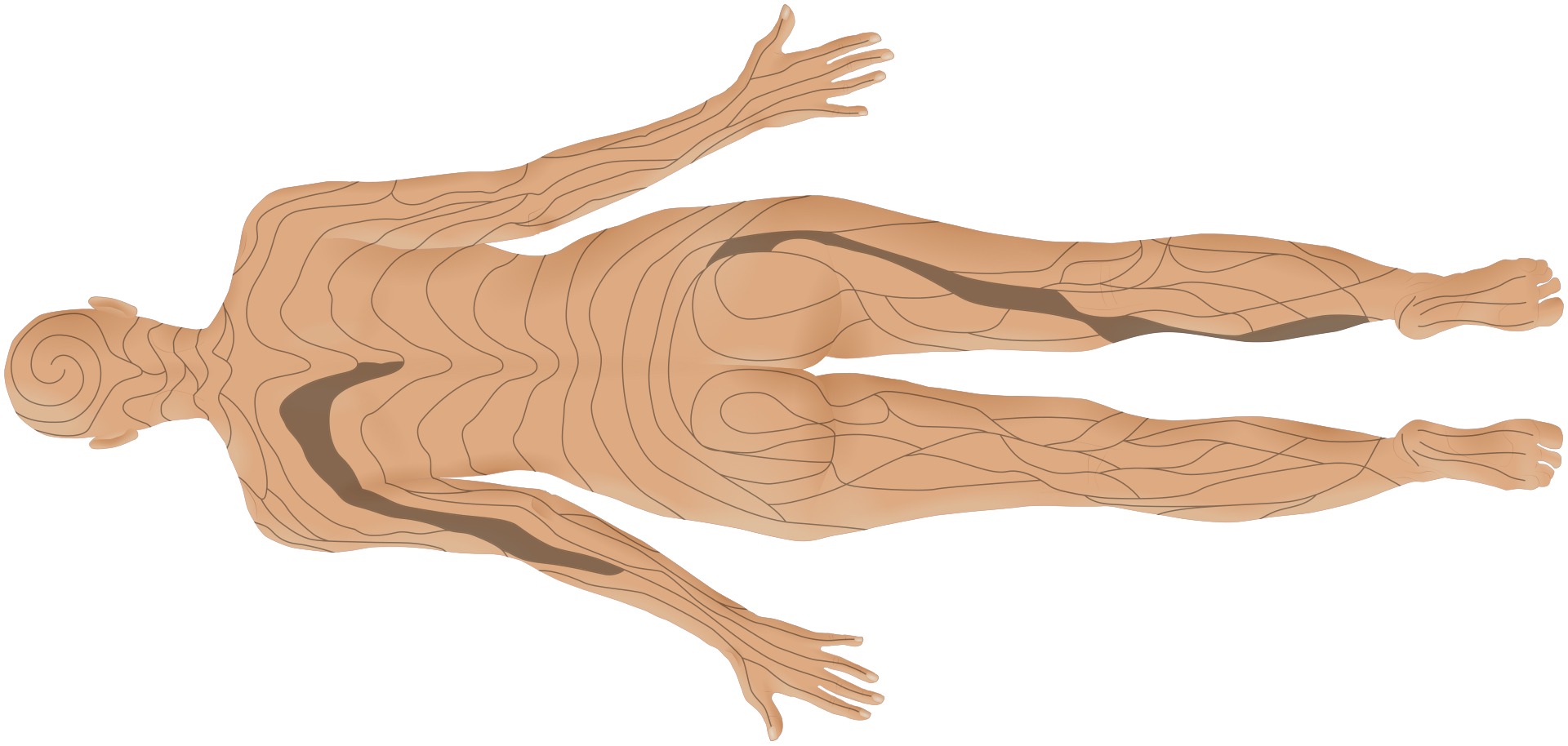  Blaschko‑vonalak női hátoldalon